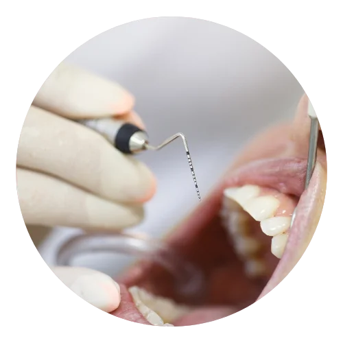 periodoncia